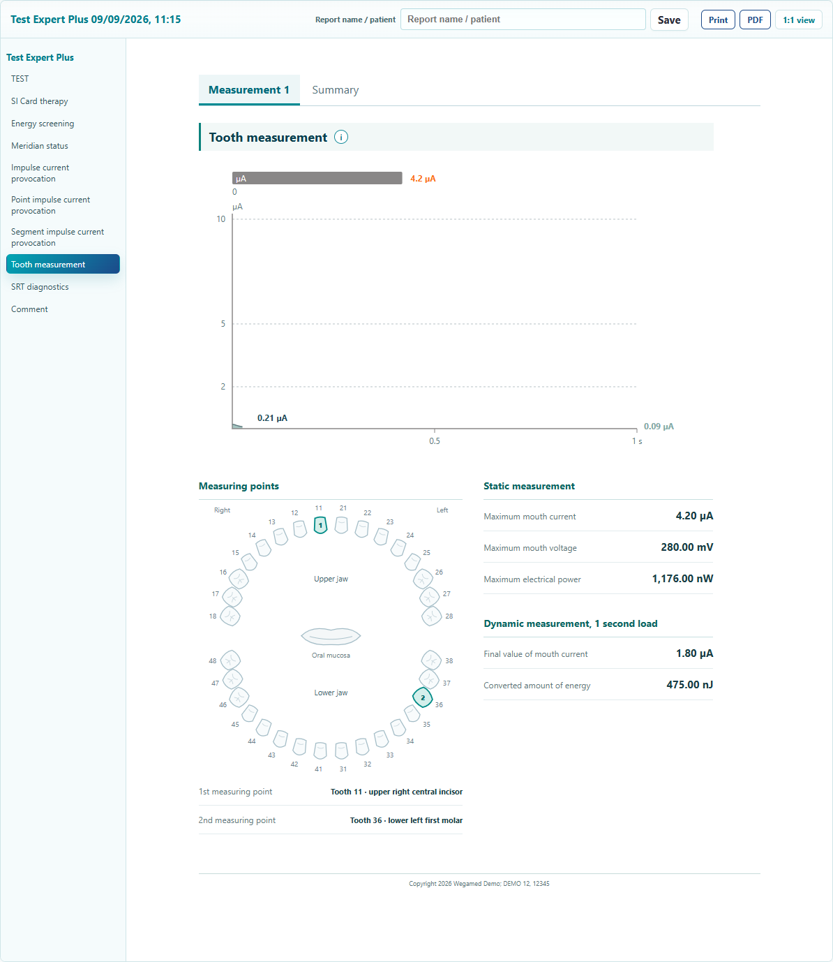 Interactive tooth measurement with secure test data